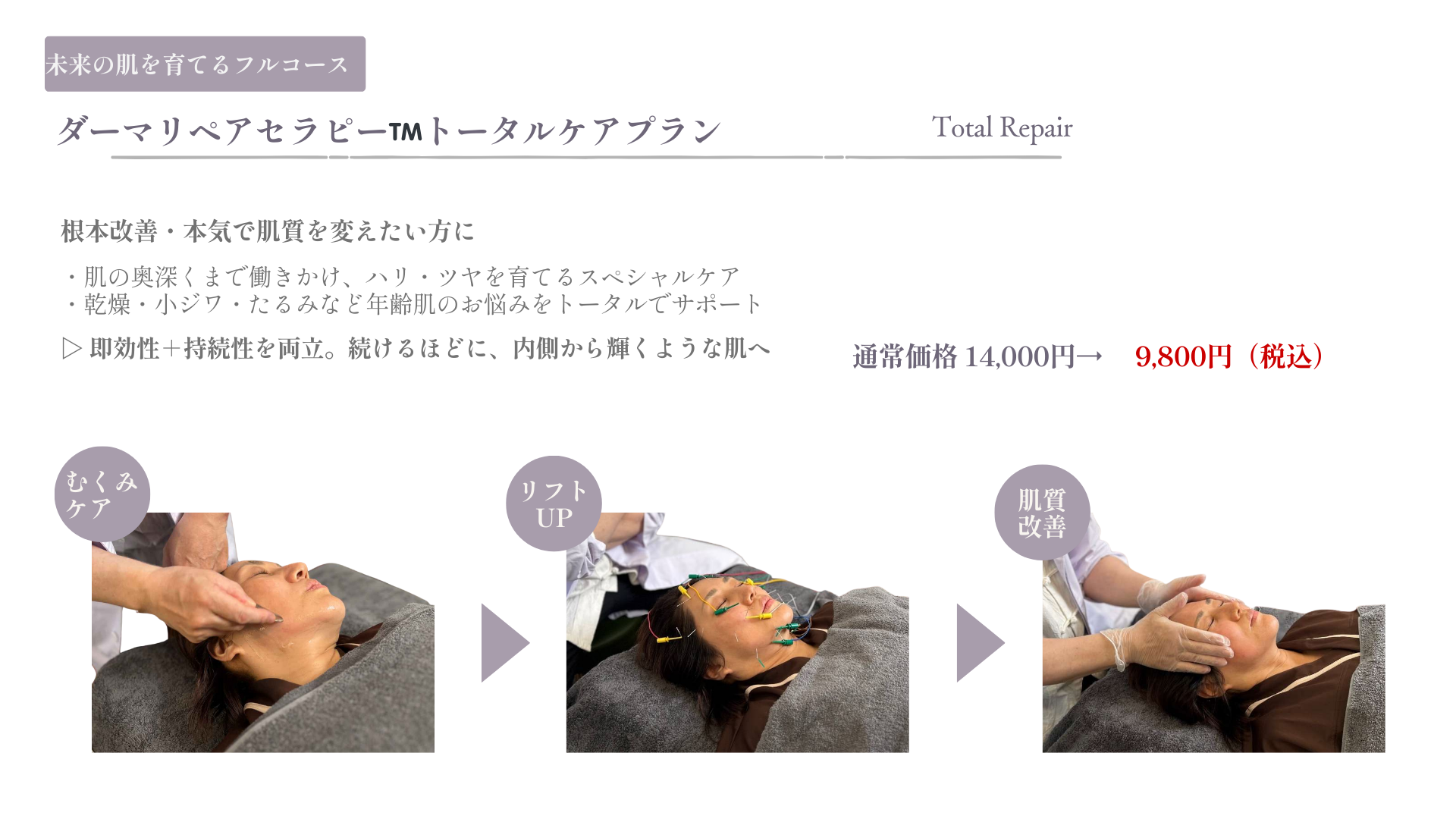 トータルケアプラン